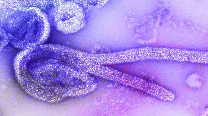Procedure operative e misure di sorveglianza sanitaria relative alla malattia da Virus Ebola(MVE)